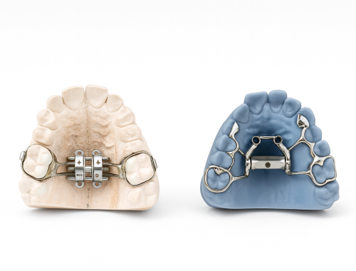 Aparatología de ortodoncia sobre modelos: expansores y dispositivos para ensanche palatino