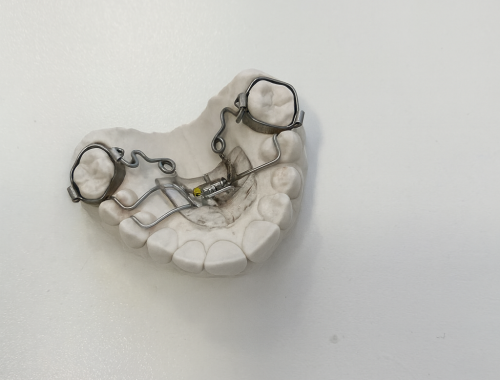 Aparato ortodóncico palatino acabado sobre modelo — control de calidad en laboratorio